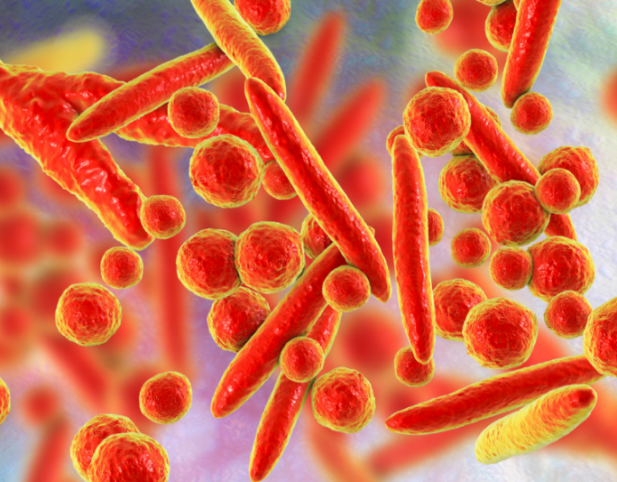 유레아플라즈마