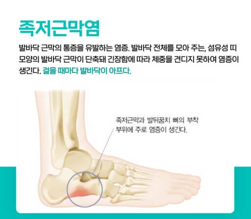 족저근막염 부위