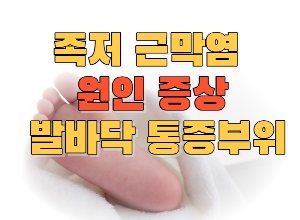 족저근막염