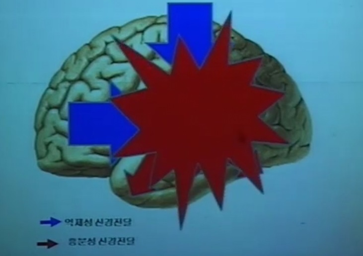 EBS명의-뇌전증-이상건-교수