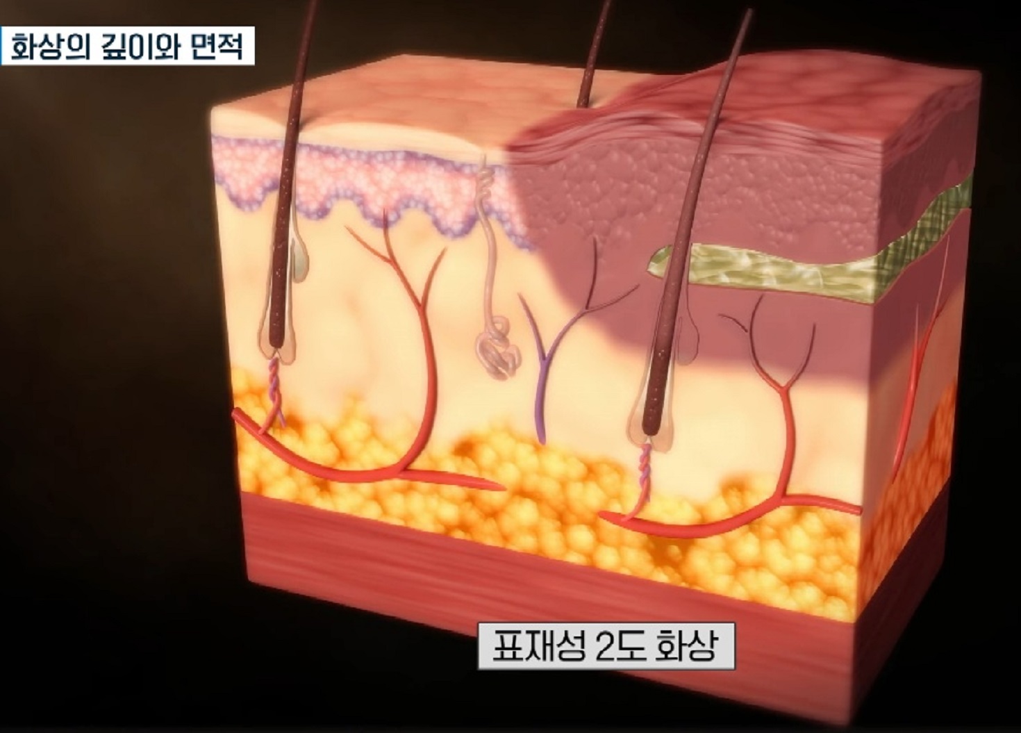 EBS명의-화상-명의