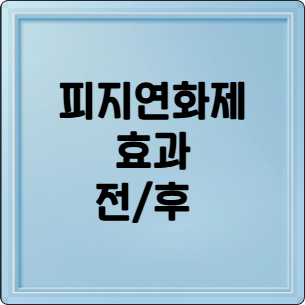 피지연화제 효과 봤다! 리얼 후기