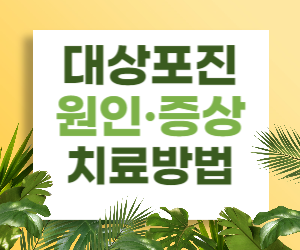 이 글을 읽기만해도, 대상포진의 원인과 증상, 치료 방법에 대해 자세히 알아볼 수 있습니다.