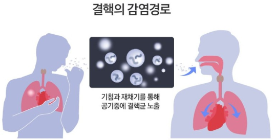 결핵의-감염-경로