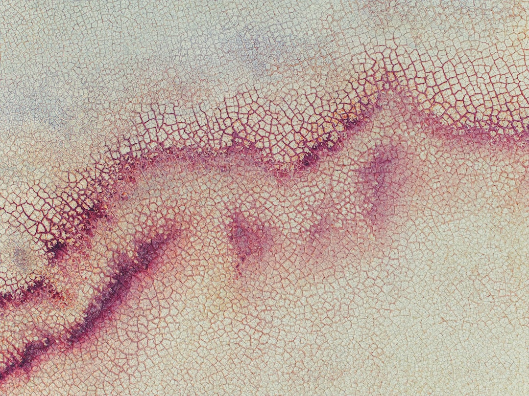 Scar