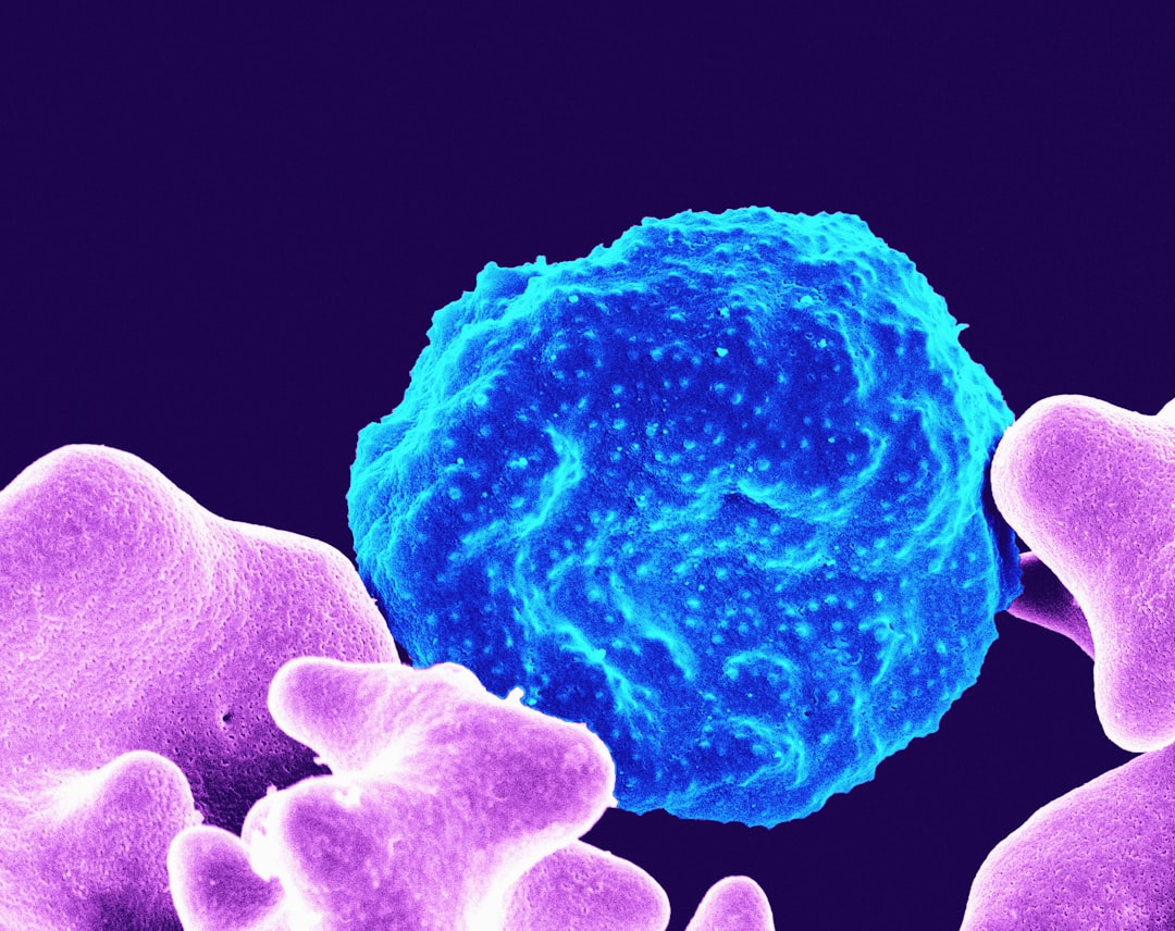 Malaria
