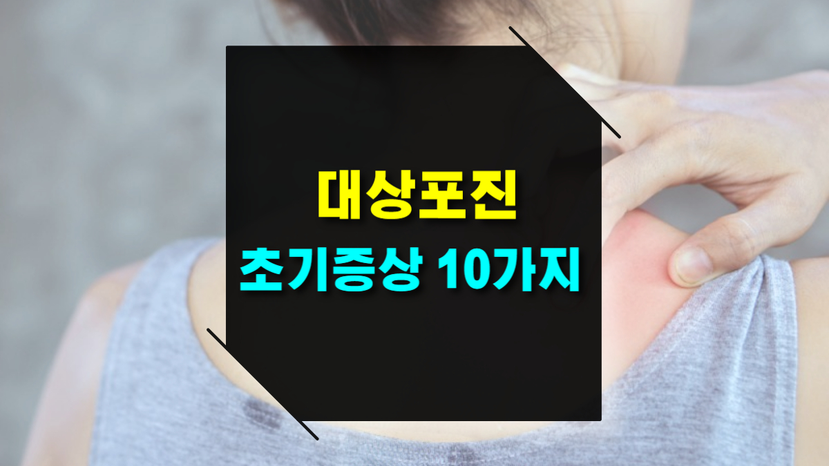 대상포진 초기 증상 10가지 조기 진단이 중요한 이유