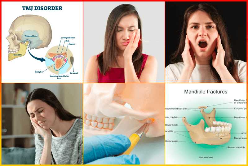 턱관절 치료 방법