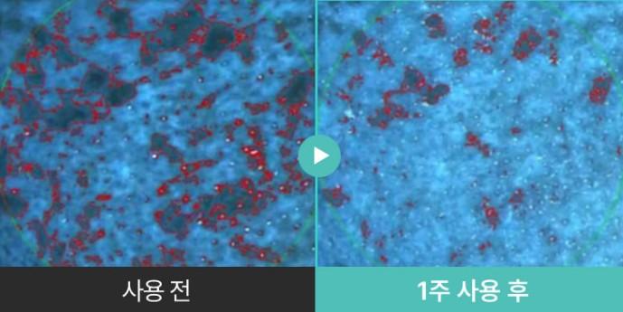 멜라케어 필크림 마스크 후기