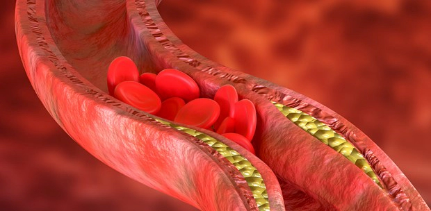 혈액순환에 좋은 음식 추천