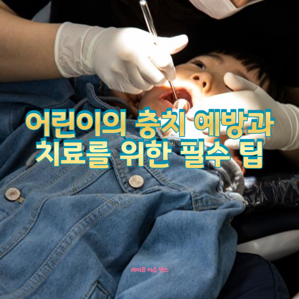 어린이 충치 치료와 예방을 위한 필수 정보