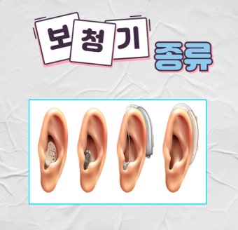보청기 국가보조금 지원 신청방법 대상자 (2)
