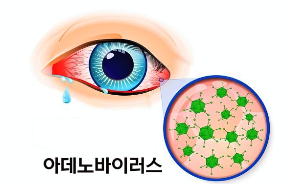 바이러스 예방과 치료