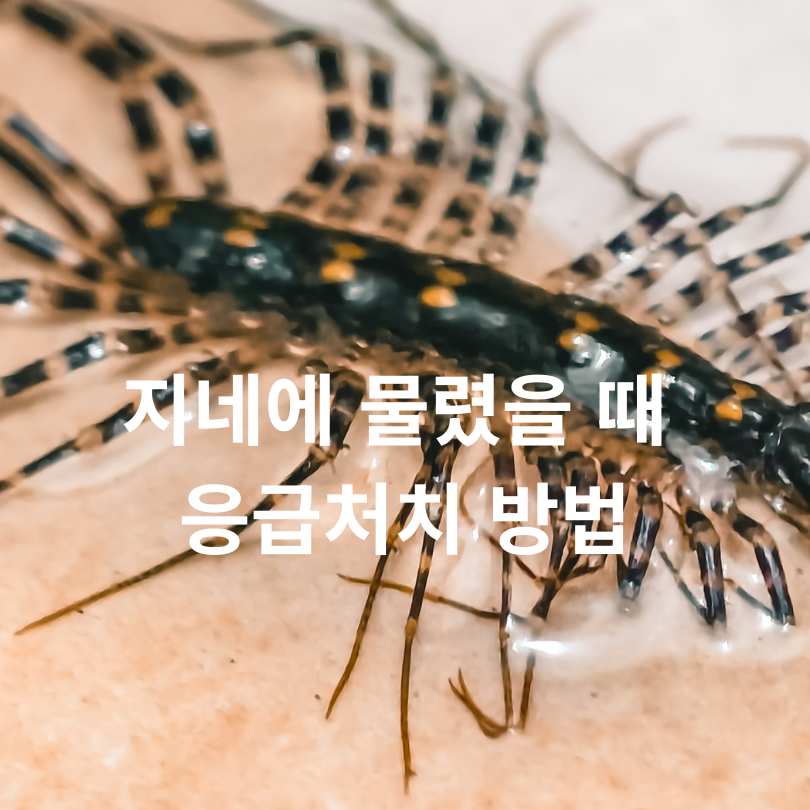 지네에 물리면 증상부터 치료까지, 꼭 알아야 할 응급 대처법