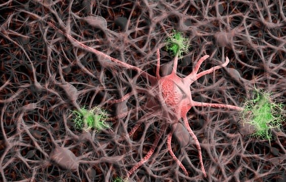 말초신경병 증상