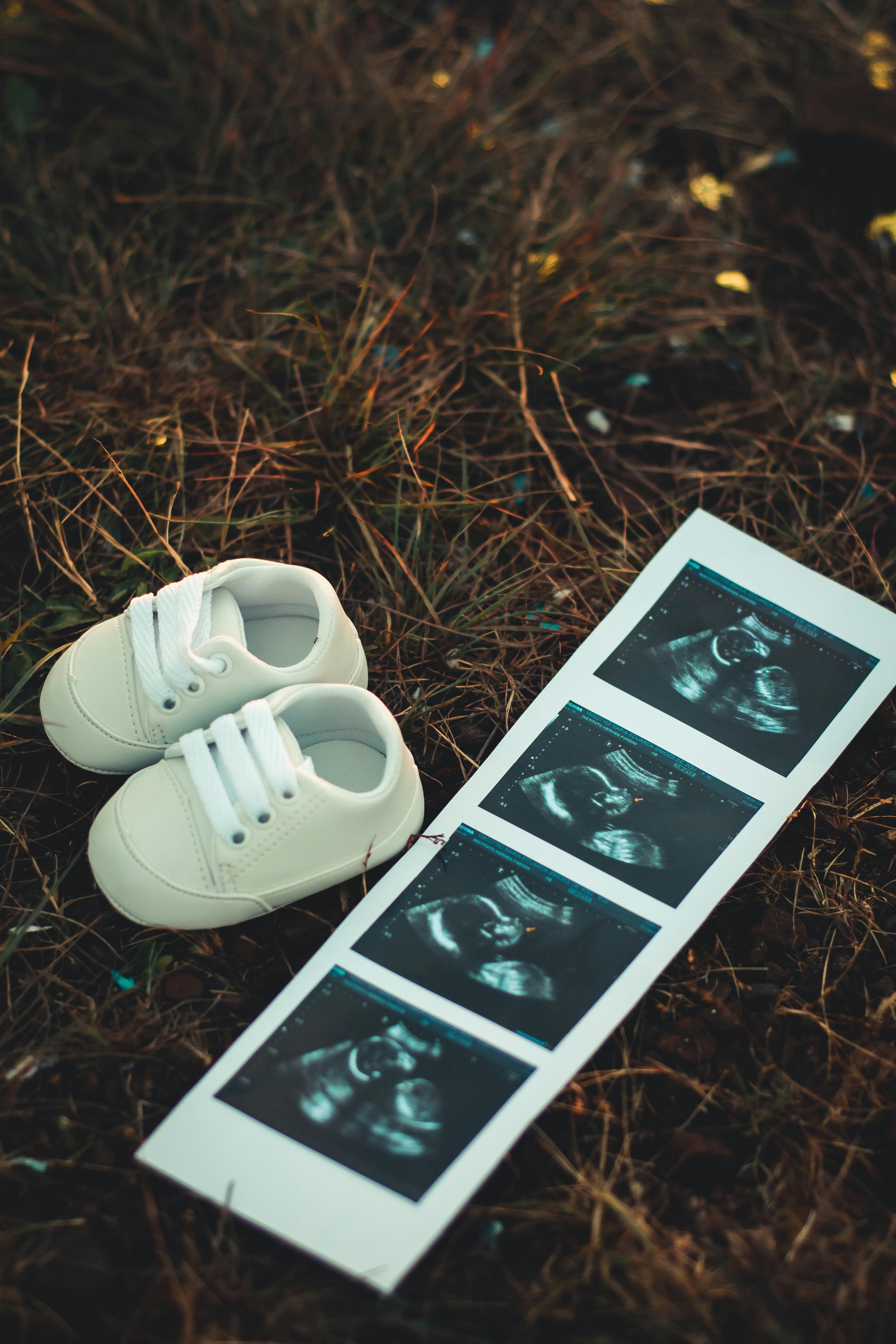 출산 준비를 위한 최고의 운동