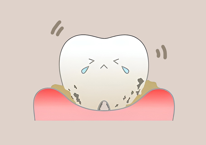 많이-흔들리는-치아-모습