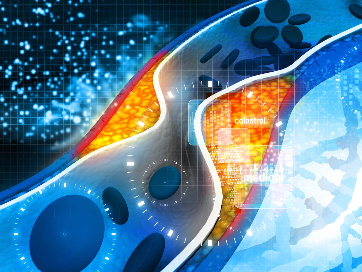 콜레스테롤 감소