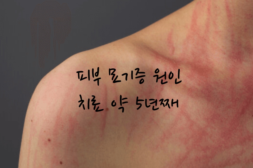 묘기증