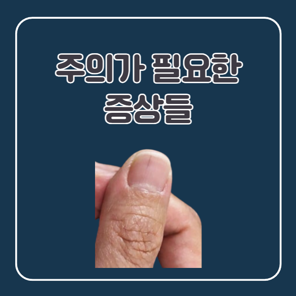 손톱 밑 검은줄 주의가 필요한 증상들