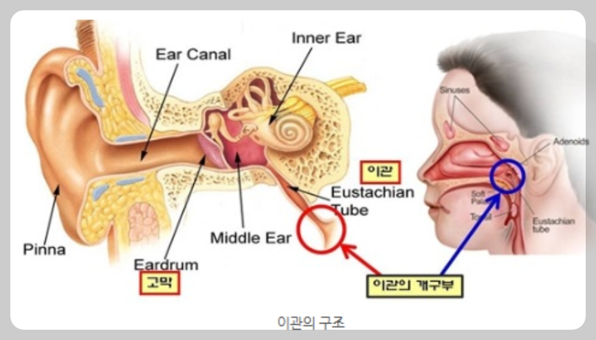 이관개방증