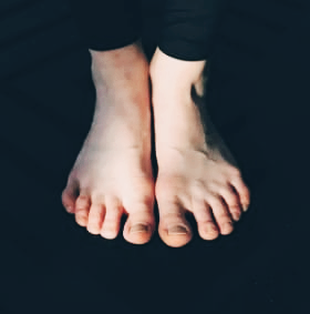 티눈 없애는 방법