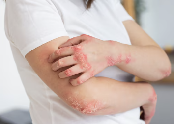 겨드랑이 통증 31