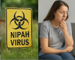 니파 바이러스