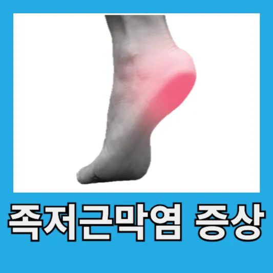 족저근막염 증상