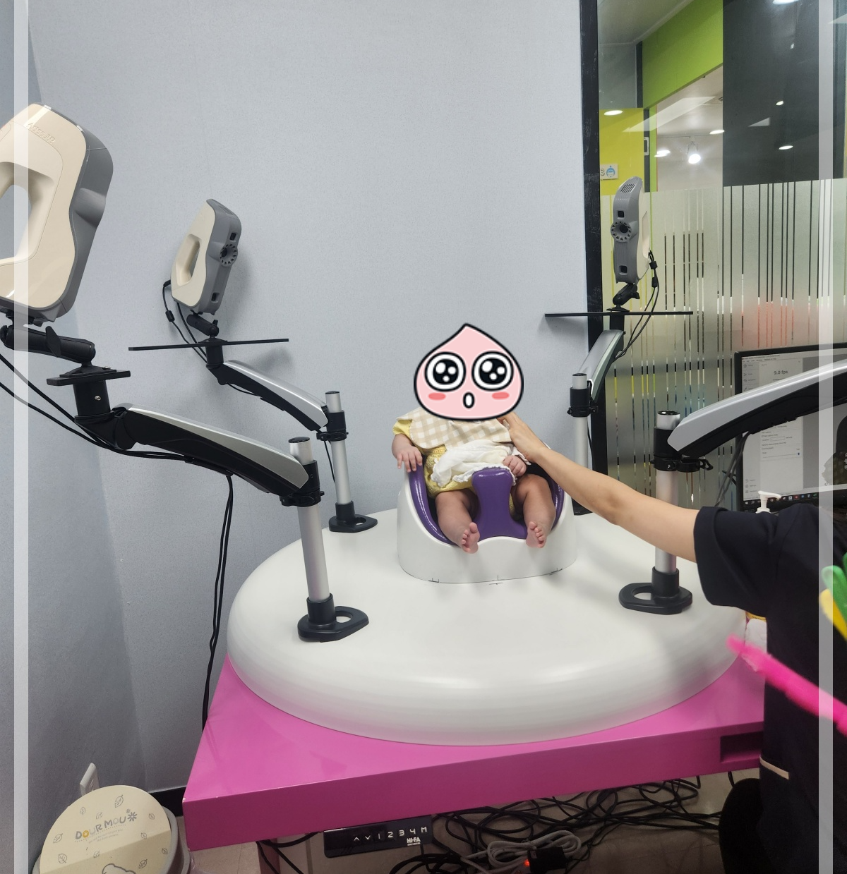 사두증 3D 진단방법