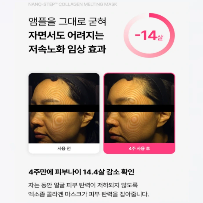 프롬메디 콜라겐팩 마스크팩 내돈내산 후기 부작용 효과 사용법