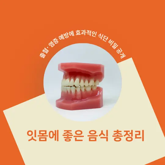 잇몸에 좋은 음식