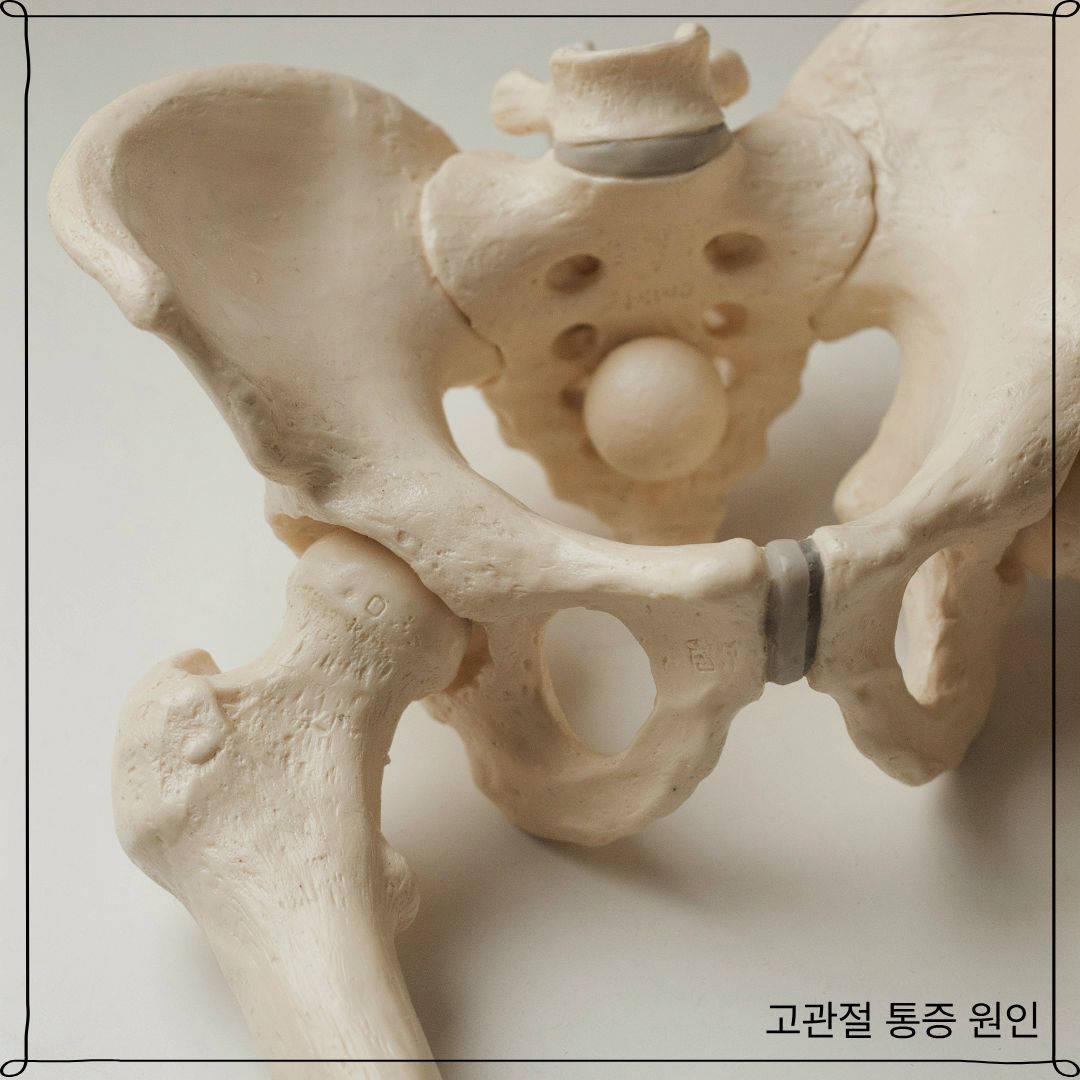 고관절 통증 원인
