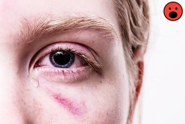 무릎 관절 통증 원인