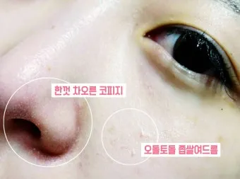 남자 얼굴 피지 제거 화장품 꿀템_23