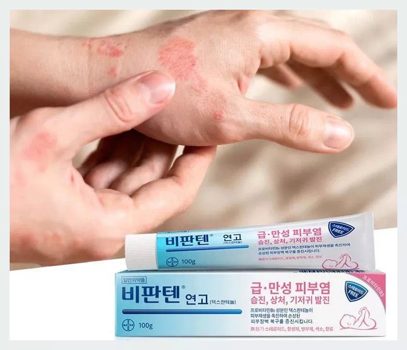 비판텐 연고: 습진