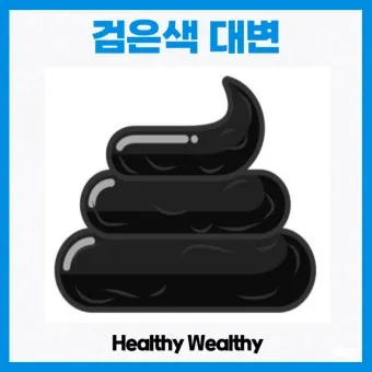 똥이 까만색 검정똥 원인과 질병 가능성_16