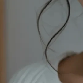 쌍꺼풀 수술 이미지 - 쌍꺼풀 수술을 한 사람