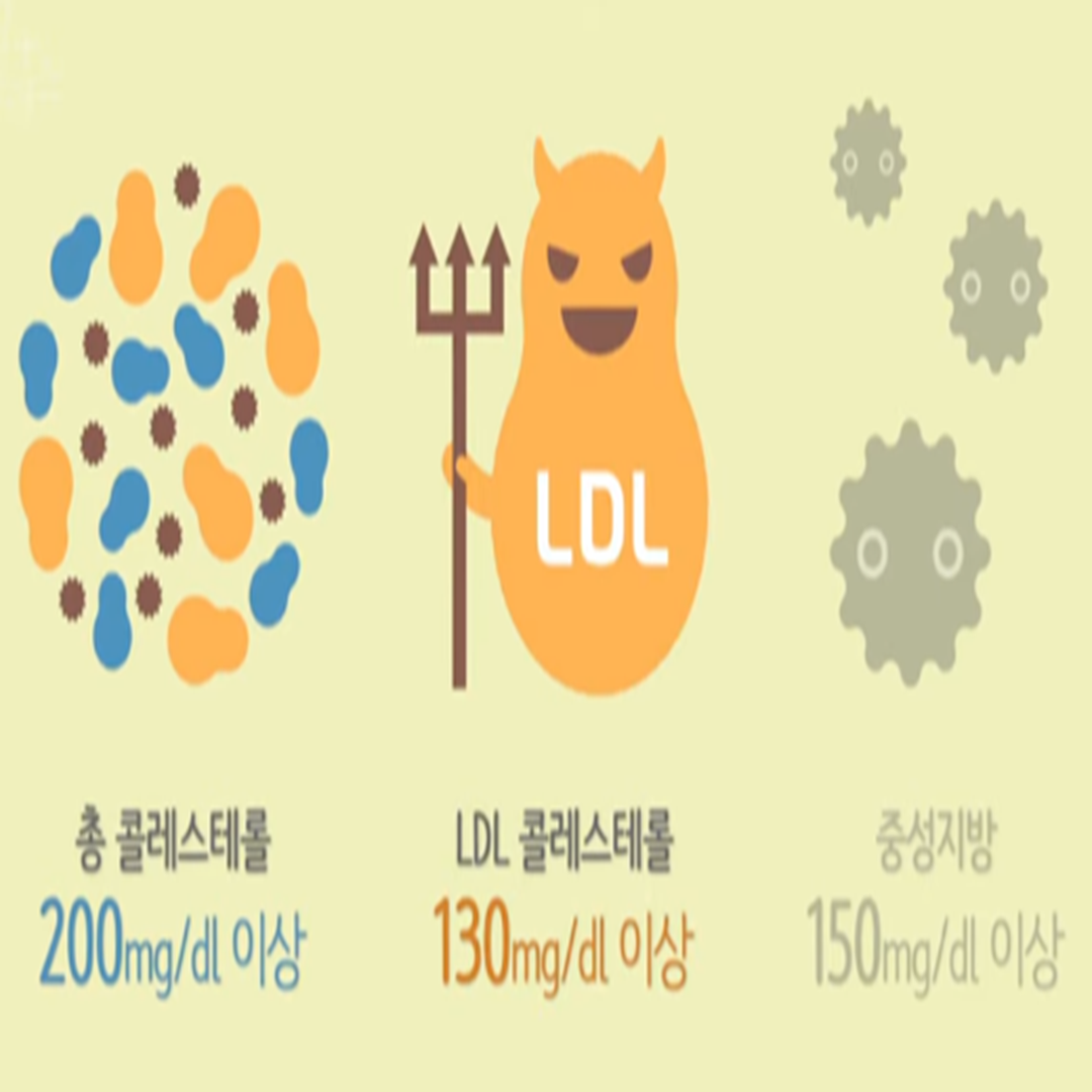 고지혈증 진단 기준