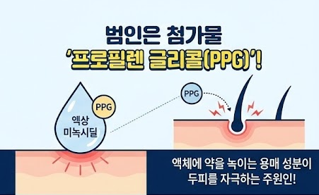 미녹시딜 부작용
