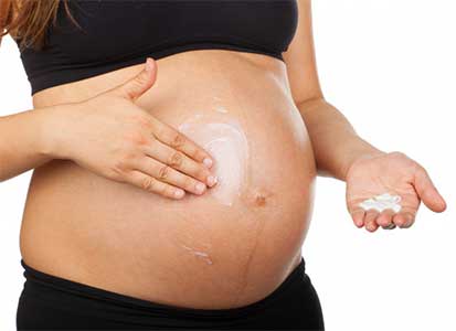 임산부-튼살-크림