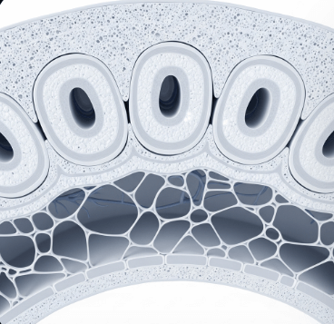 골감소증과 골다공증 차이점