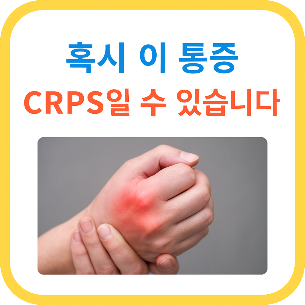 CRPS로 인한 통증을 나타낸 붉은 손 이미지와 '혹시 이 통증, CRPS일 수 있습니다'라는 경고 문구