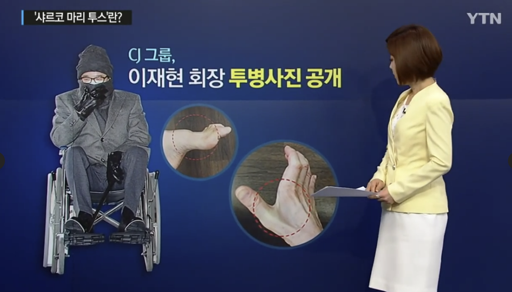 삼성가 이부진 사장 걸음걸이와 샤르코 마리 투스 유전병 팩트체크