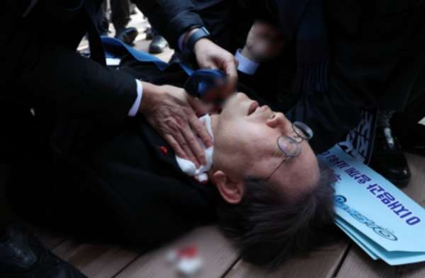 이재명대표 피습