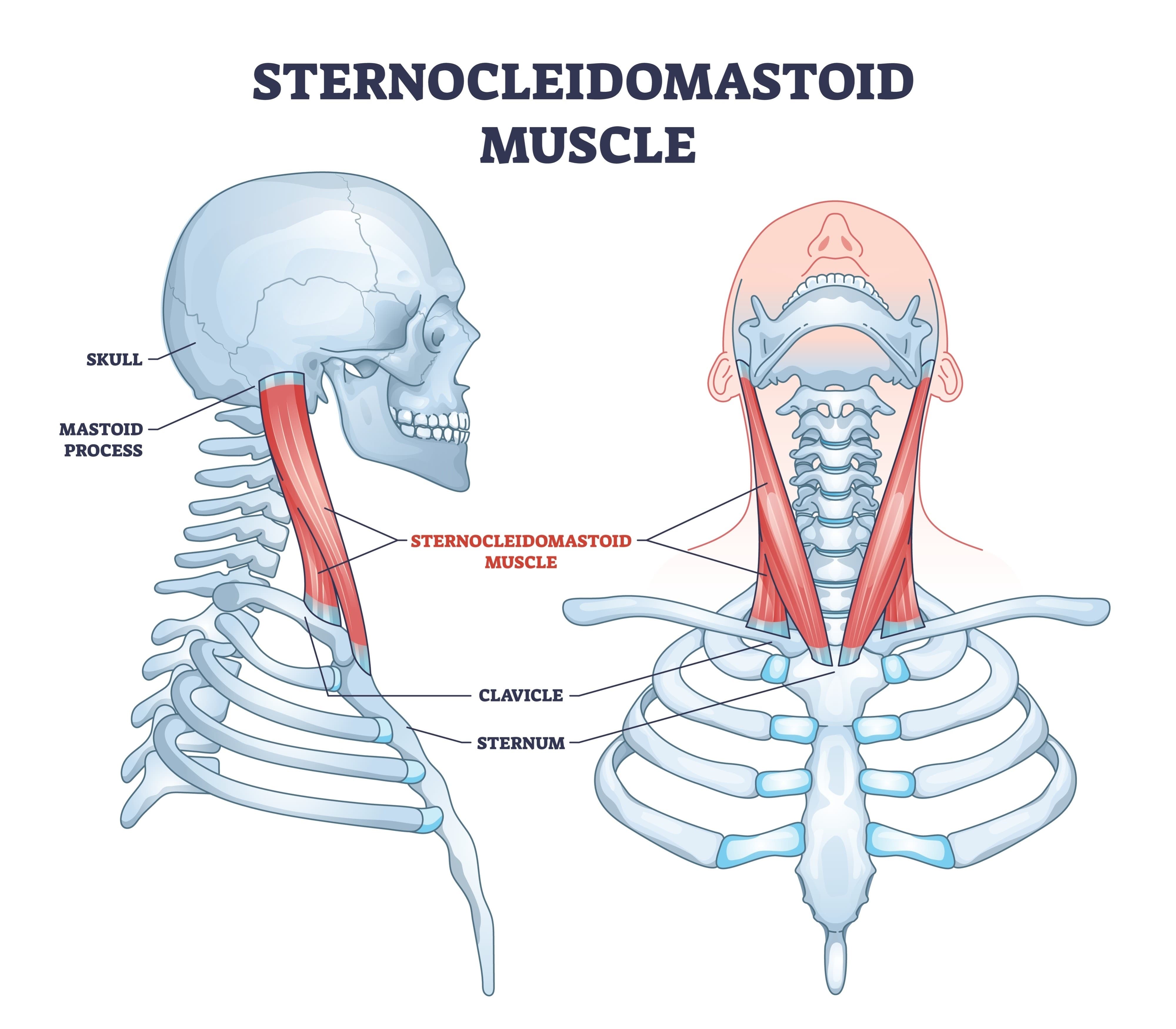 Sternocleidomastoid muscle