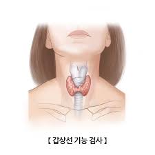갑상선 기능 저하증