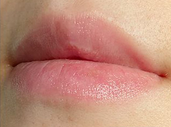 바세린 입술 효과