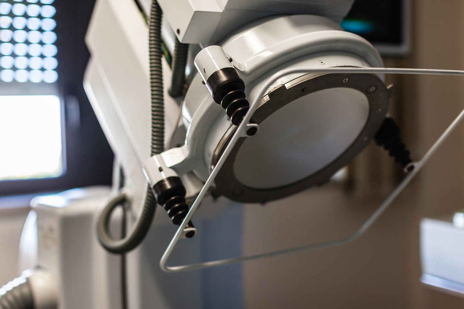 체외충격파 쇄석술(ESWL) – 10mm 이하 결석 치료