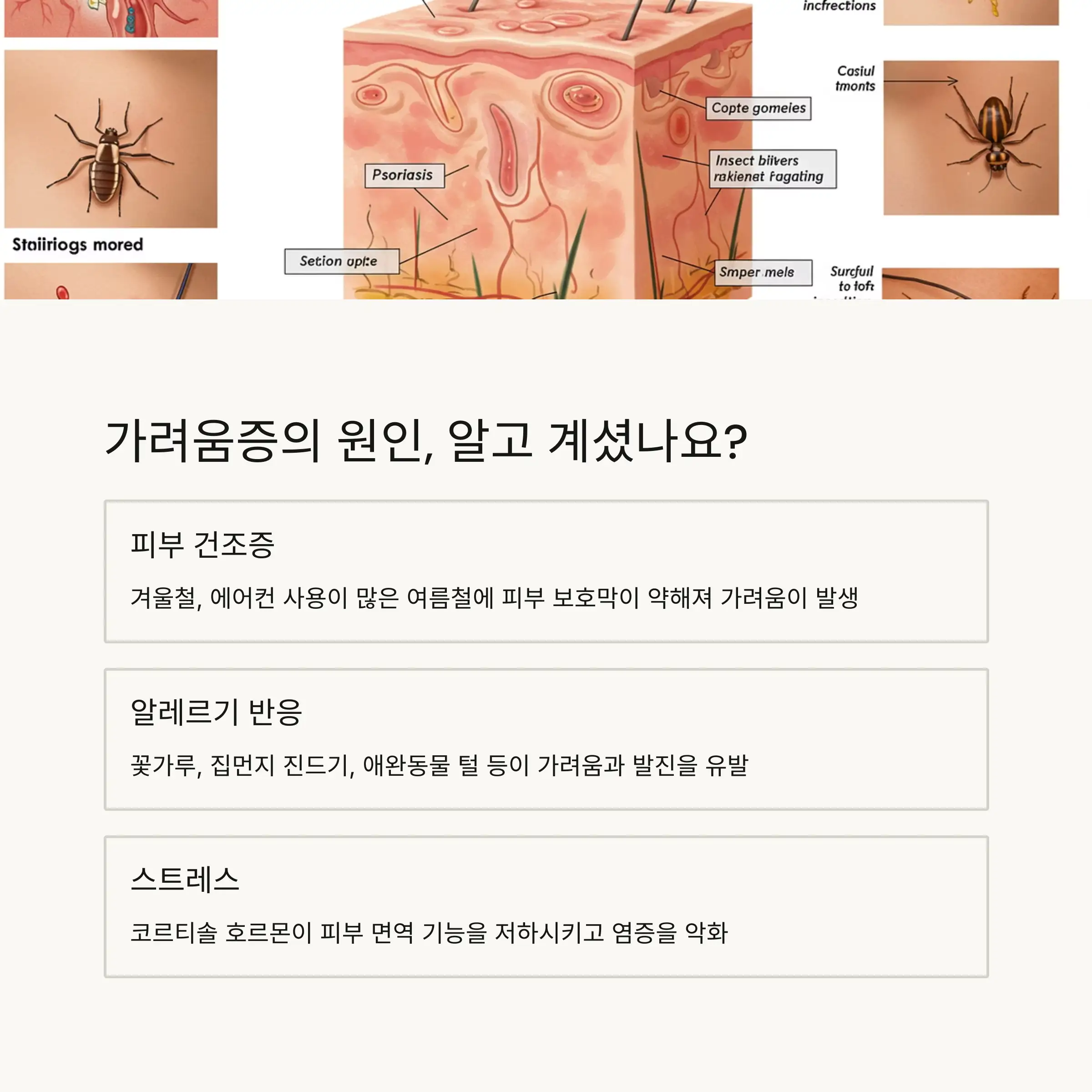 🔍 피부 가려움증의 주요 원인